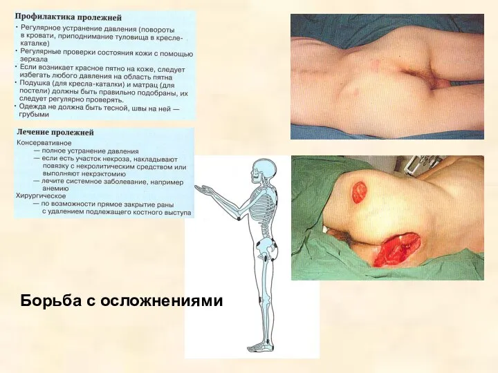 Борьба с осложнениями