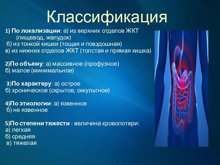 Классификация 1) По локализации: а) из верхних отделов ЖКТ (пищевод, желудок) б)