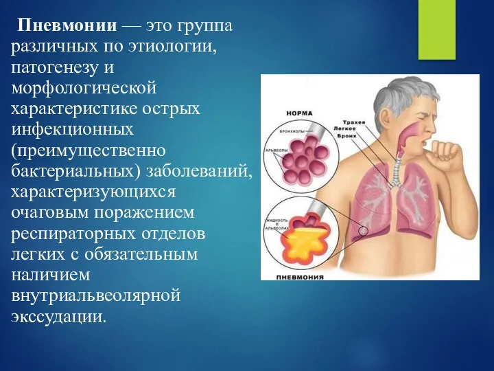 Пневмонии — это группа различных по этиологии, патогенезу и морфологической характеристике острых