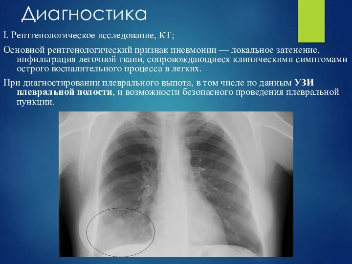 Диагностика I. Рентгенологическое исследование, КТ; Основной рентгенологический признак пневмонии — локальное затенение,