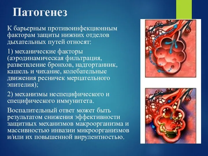 Патогенез К барьерным противоинфекционным факторам защиты нижних отделов дыхательных путей относят: 1)