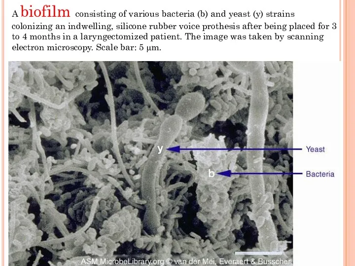 A biofilm consisting of various bacteria (b) and yeast (y) strains colonizing