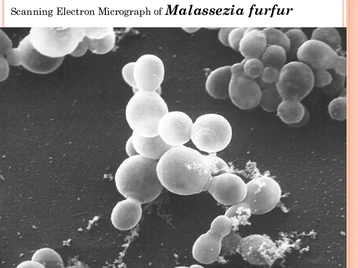 Scanning Electron Micrograph of Malassezia furfur