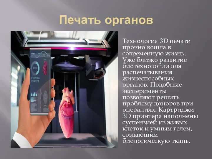 Печать органов Технология 3D печати прочно вошла в современную жизнь. Уже близко