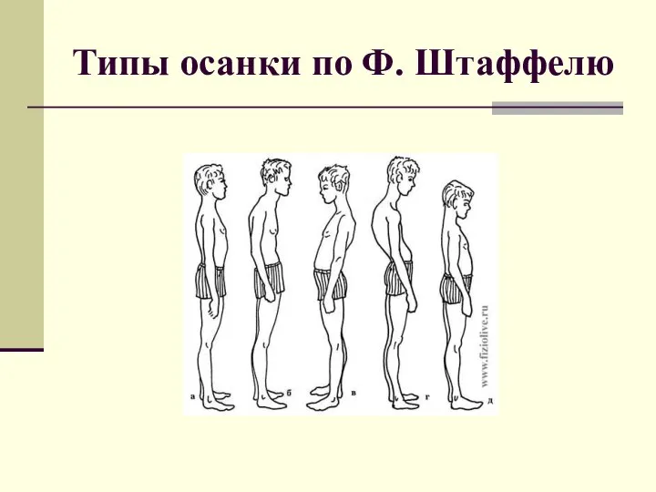 Типы осанки по Ф. Штаффелю