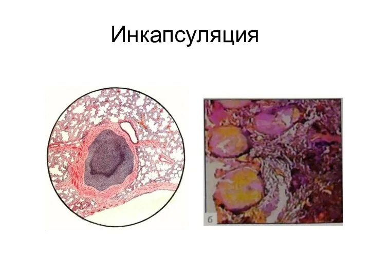 Инкапсуляция