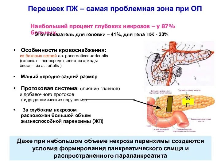 Перешеек ПЖ – самая проблемная зона при ОП Особенности кровоснабжения: из боковых