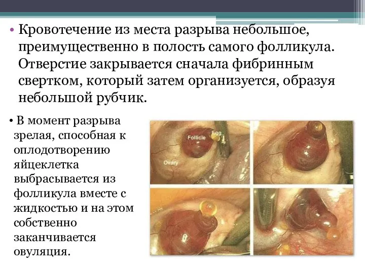 Кровотечение из места разрыва небольшое, преимущественно в полость самого фолликула. Отверстие закрывается