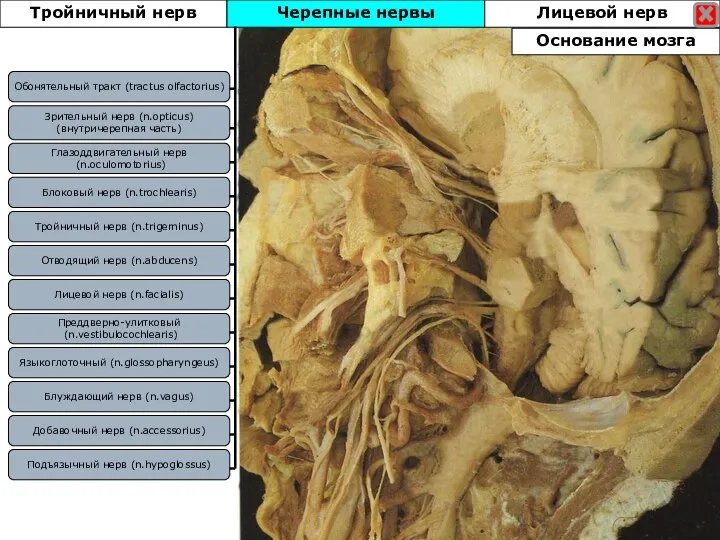 Черепные нервы Лицевой нерв Блоковый нерв (n.trochlearis) Зрительный нерв (n.opticus) (внутричерепная часть)