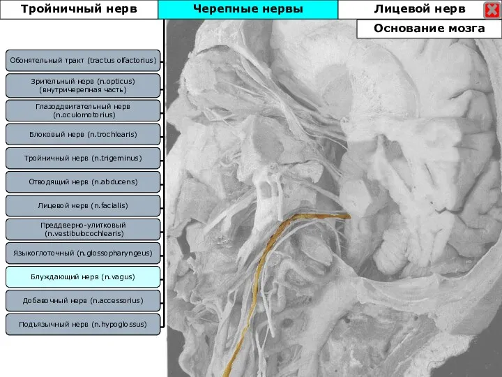 Тройничный нерв Блоковый нерв (n.trochlearis) Зрительный нерв (n.opticus) (внутричерепная часть) Отводящий нерв