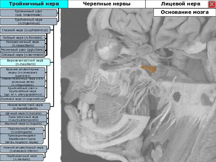 Тройничный нерв Тройничны узел (ggl. trigeminale) Тройничный нерв (n.trigeminus) Глазной нерв (n.ophtalmicus)