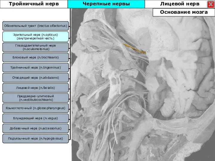 Блоковый нерв (n.trochlearis) Зрительный нерв (n.opticus) (внутричерепная часть) Отводящий нерв (n.abducens) Тройничный