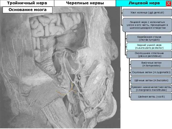 Лицевой нерв Тройничный нерв Узел коленца (ggl.geniculi) Лицевой нерв с коленчатым узлом