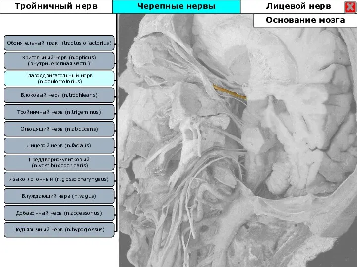 Блоковый нерв (n.trochlearis) Зрительный нерв (n.opticus) (внутричерепная часть) Отводящий нерв (n.abducens) Тройничный
