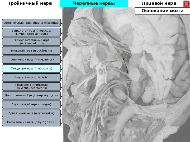 Блоковый нерв (n.trochlearis) Зрительный нерв (n.opticus) (внутричерепная часть) Отводящий нерв (n.abducens) Тройничный