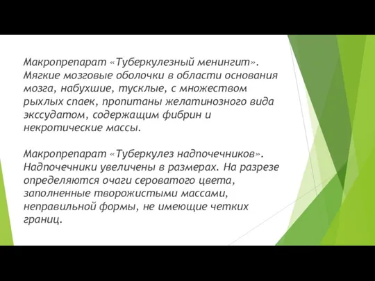 Макропрепарат «Туберкулезный менингит». Мягкие мозговые оболочки в области основания мозга, набухшие, тусклые,