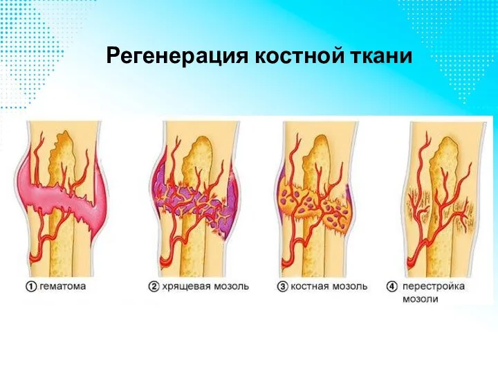 Регенерация костной ткани