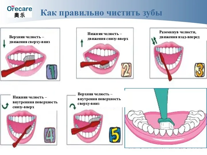 Как правильно чистить зубы Верхняя челюсть – движения сверху-вниз Нижняя челюсть –