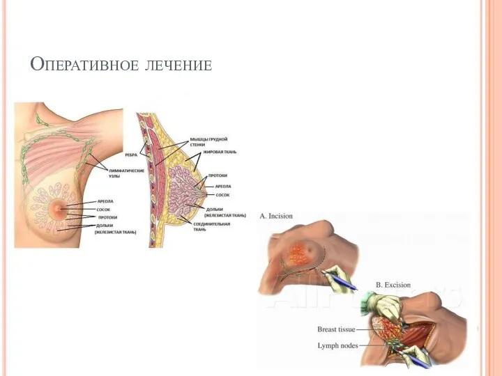 Оперативное лечение