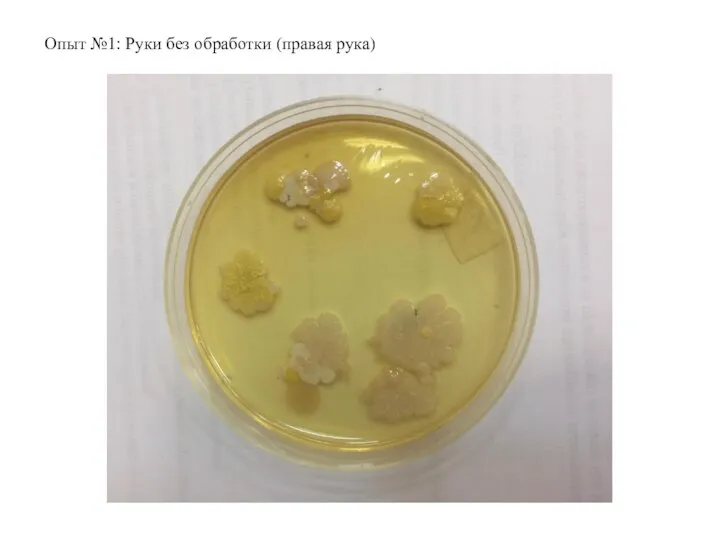 Опыт №1: Руки без обработки (правая рука)