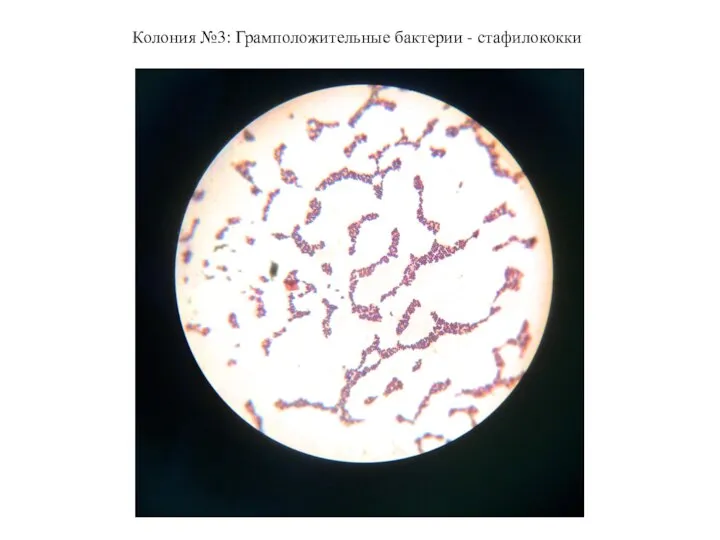 Колония №3: Грамположительные бактерии - стафилококки