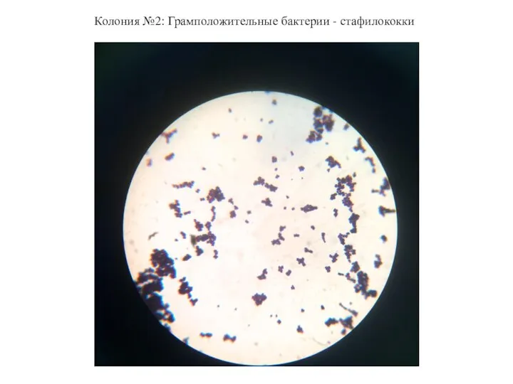 Колония №2: Грамположительные бактерии - стафилококки