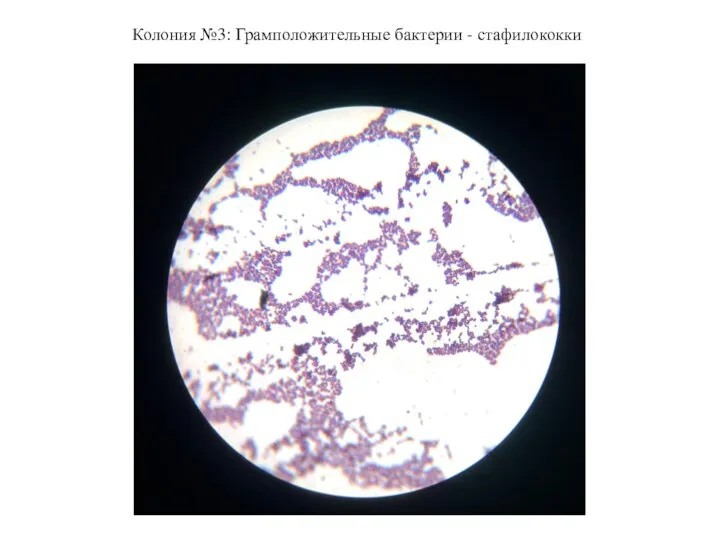 Колония №3: Грамположительные бактерии - стафилококки