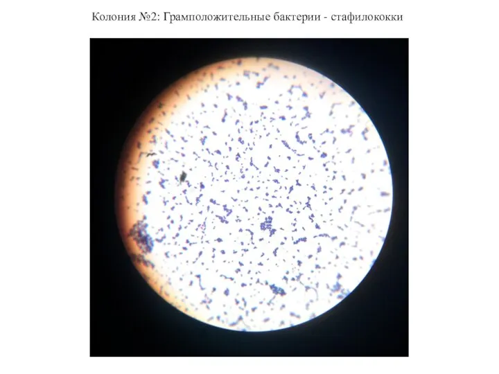 Колония №2: Грамположительные бактерии - стафилококки