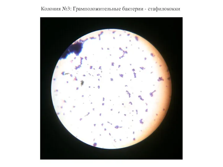 Колония №3: Грамположительные бактерии - стафилококки