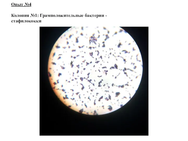 Опыт №4 Колония №1: Грамположительные бактерии - стафилококки