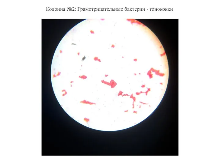 Колония №2: Грамотрицательные бактерии - гонококки