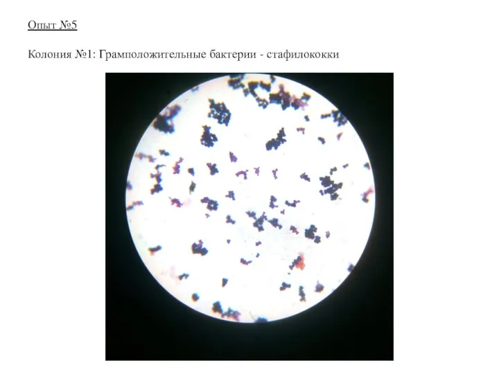 Опыт №5 Колония №1: Грамположительные бактерии - стафилококки