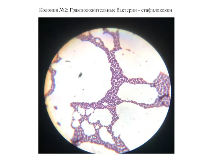 Колония №2: Грамположительные бактерии - стафилококки