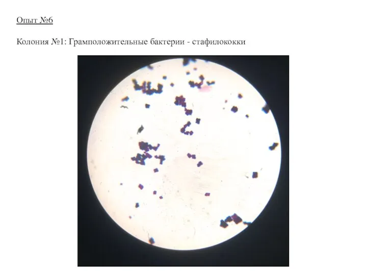 Опыт №6 Колония №1: Грамположительные бактерии - стафилококки