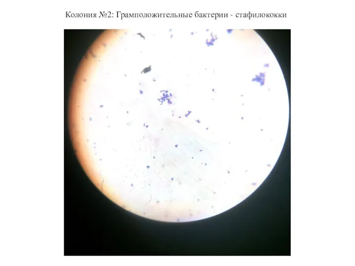 Колония №2: Грамположительные бактерии - стафилококки