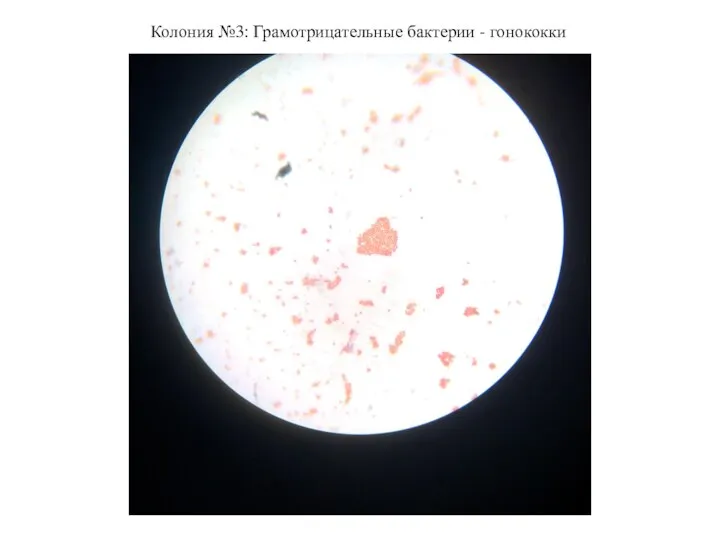 Колония №3: Грамотрицательные бактерии - гонококки