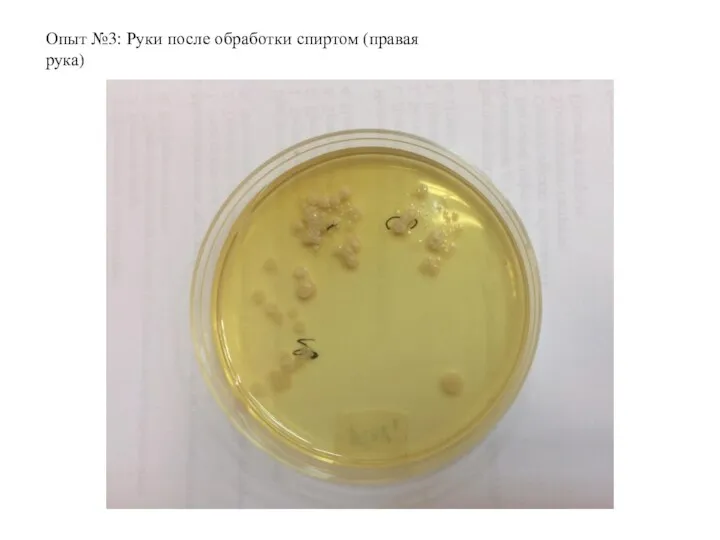 Опыт №3: Руки после обработки спиртом (правая рука)