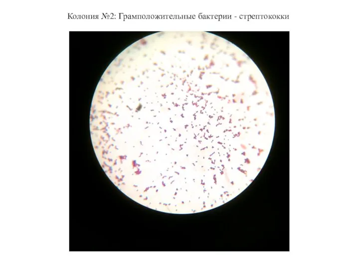 Колония №2: Грамположительные бактерии - стрептококки
