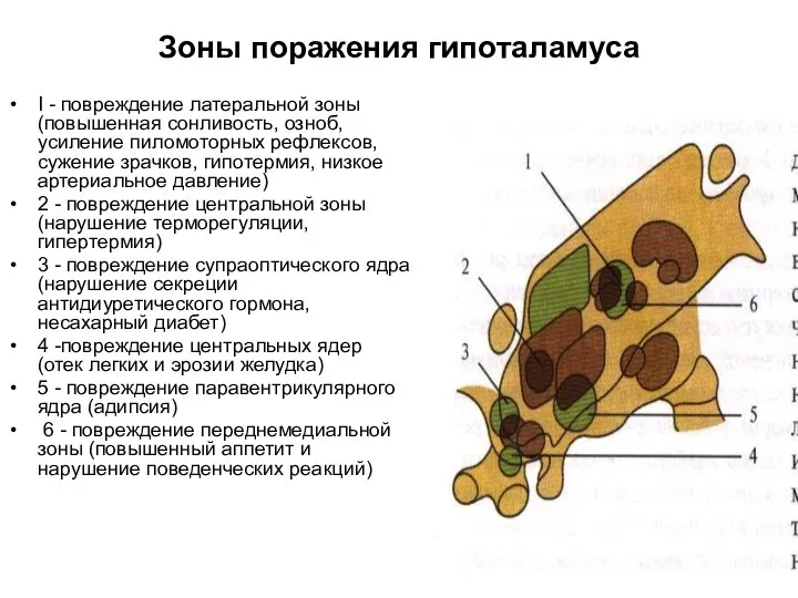 Зоны поражения гипоталамуса I - повреждение латеральной зоны (повышенная сонливость, озноб, усиление