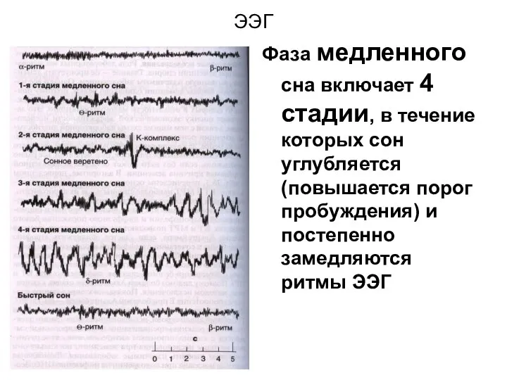 ЭЭГ Фаза медленного сна включает 4 стадии, в течение которых сон углубляется