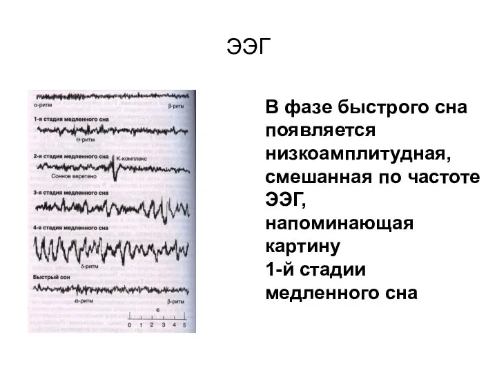 ЭЭГ В фазе быстрого сна появляется низкоамплитудная, смешанная по частоте ЭЭГ, напоминающая
