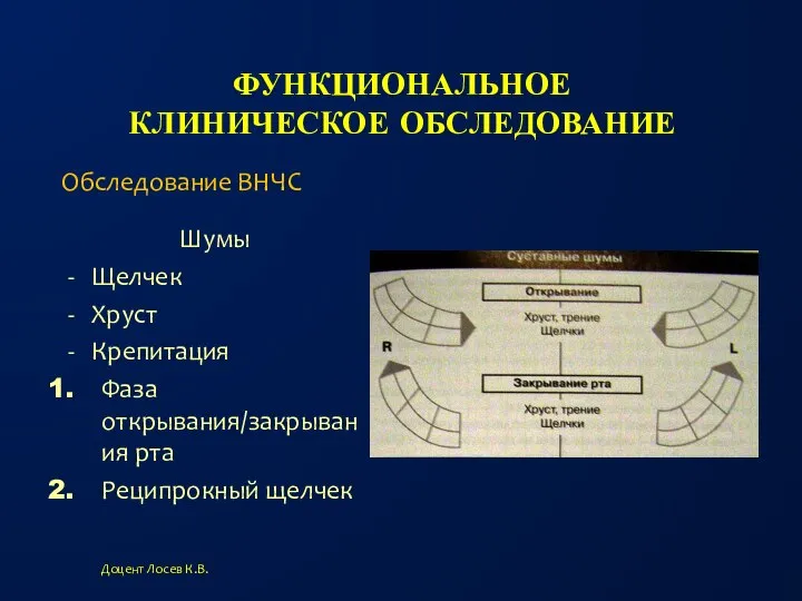 ФУНКЦИОНАЛЬНОЕ КЛИНИЧЕСКОЕ ОБСЛЕДОВАНИЕ Шумы Щелчек Хруст Крепитация Фаза открывания/закрывания рта Реципрокный щелчек