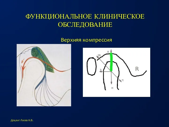 ФУНКЦИОНАЛЬНОЕ КЛИНИЧЕСКОЕ ОБСЛЕДОВАНИЕ Доцент Лосев К.В. Верхняя компрессия