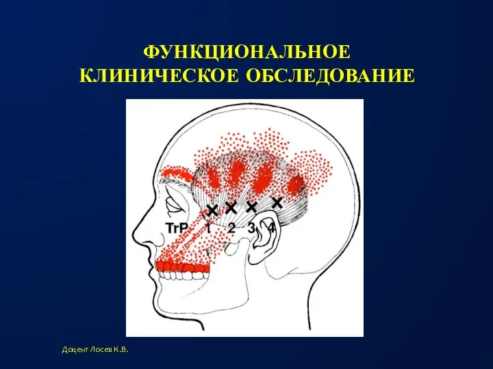 ФУНКЦИОНАЛЬНОЕ КЛИНИЧЕСКОЕ ОБСЛЕДОВАНИЕ Доцент Лосев К.В. Пальпация височной мышцы