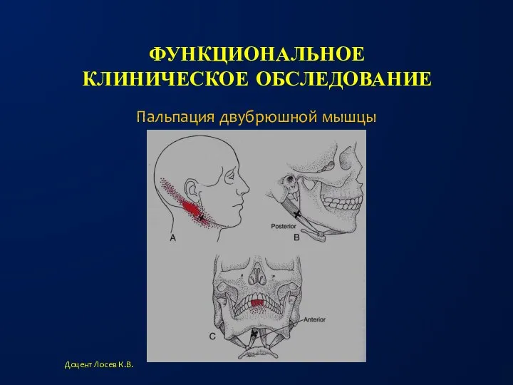 ФУНКЦИОНАЛЬНОЕ КЛИНИЧЕСКОЕ ОБСЛЕДОВАНИЕ Доцент Лосев К.В. Пальпация двубрюшной мышцы