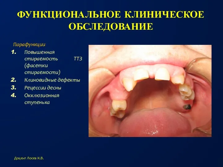 ФУНКЦИОНАЛЬНОЕ КЛИНИЧЕСКОЕ ОБСЛЕДОВАНИЕ Парафункции Повышенная стираемость ТТЗ (фасетки стираемости) Клиновидные дефекты Рецессии