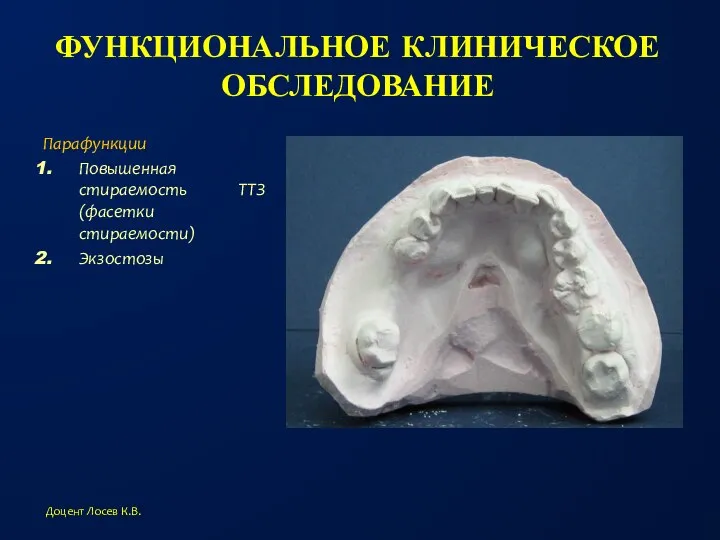 ФУНКЦИОНАЛЬНОЕ КЛИНИЧЕСКОЕ ОБСЛЕДОВАНИЕ Парафункции Повышенная стираемость ТТЗ (фасетки стираемости) Экзостозы Доцент Лосев К.В.