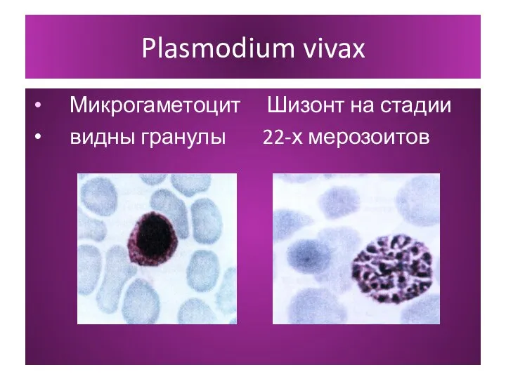 Plasmodium vivax Микрогаметоцит Шизонт на стадии видны гранулы 22-х мерозоитов
