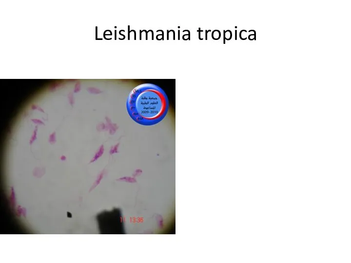 Leishmania tropica