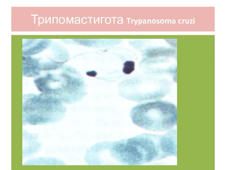 Трипомастигота Trypanosoma cruzi